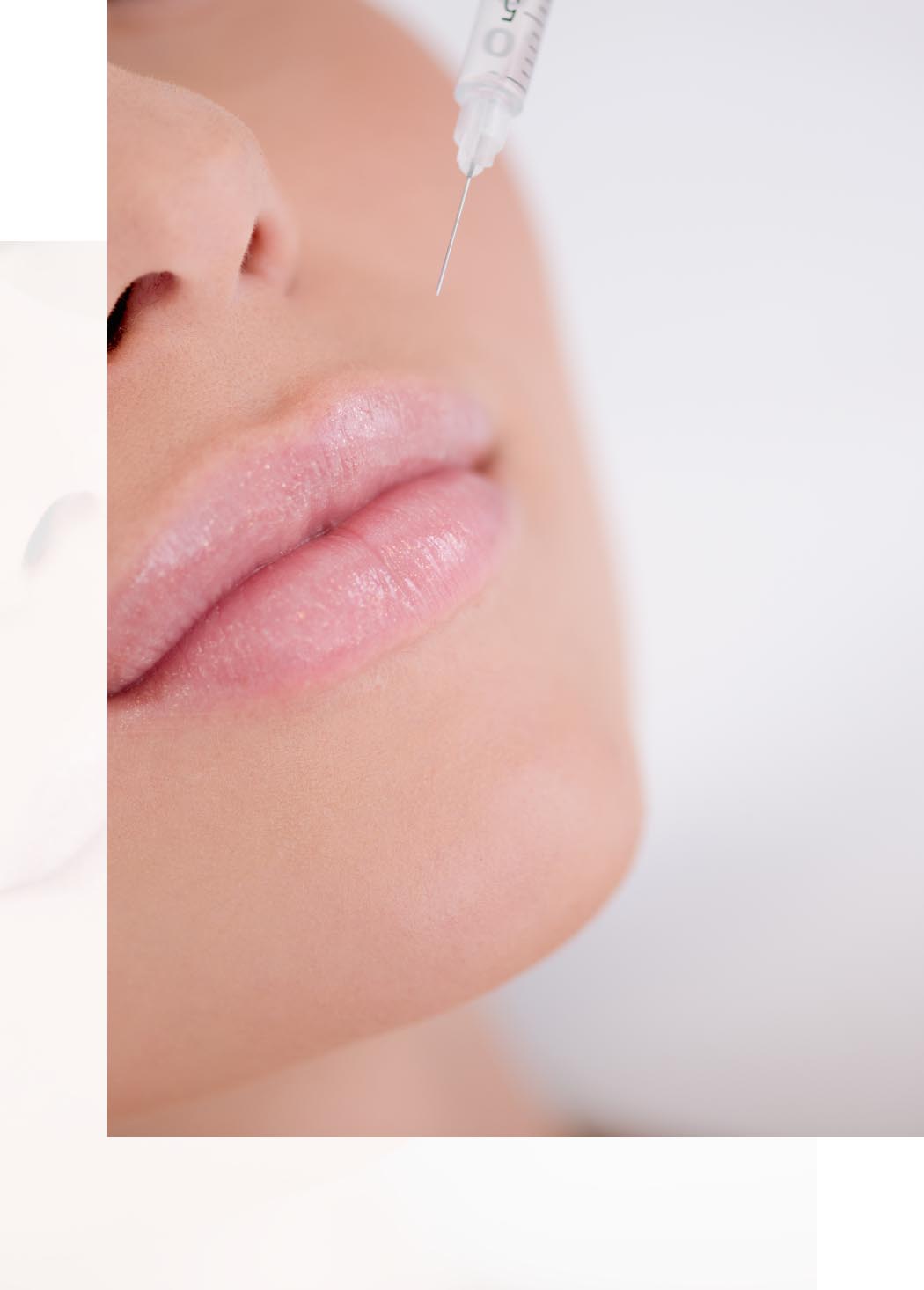 Lip Fillers Cosmetic Treatments