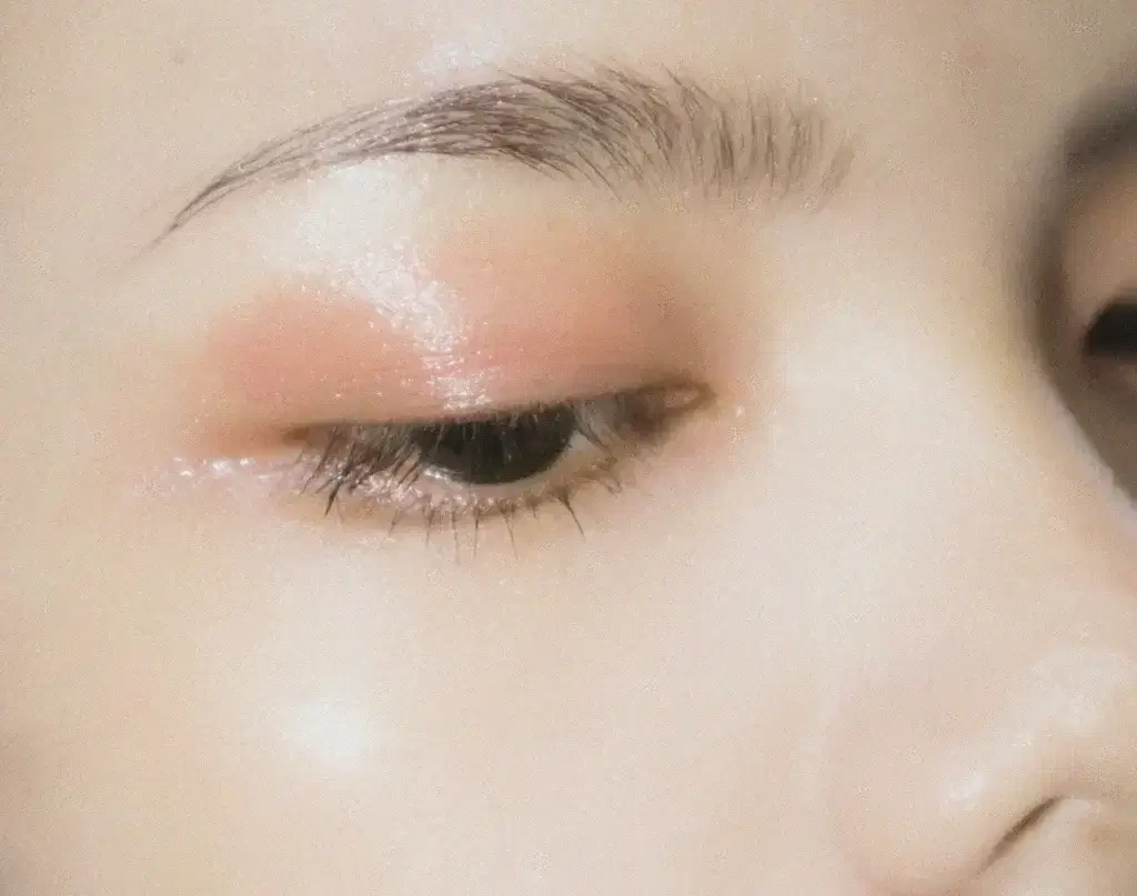 what is dermal filler