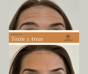 3 Areas Before and After