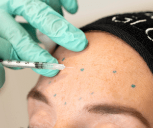 Marking Face for Treatment