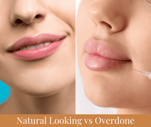 Natural vs Overdone