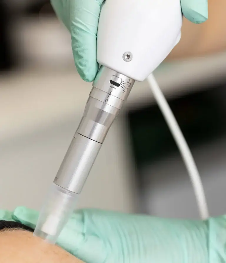 Medical microneedling at Helen Hunt Medical Aesthetics